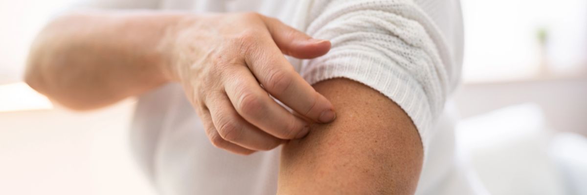 Dry and Itchy Skin in Menopause