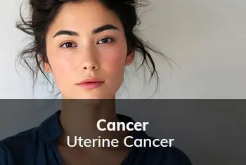 Uterine Cancer