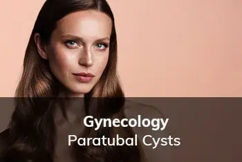Paratubal-Cyst, Dr. Thais Aliabadi | Top Gynecological Surgeon